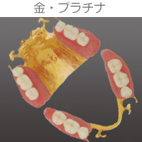 プラスチックインレー